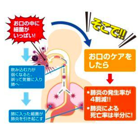 誤嚥性肺炎、予防歯科